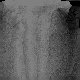 participation_au_projet:graphismes:habits_occlusion_torso1_bras_homme.jpg